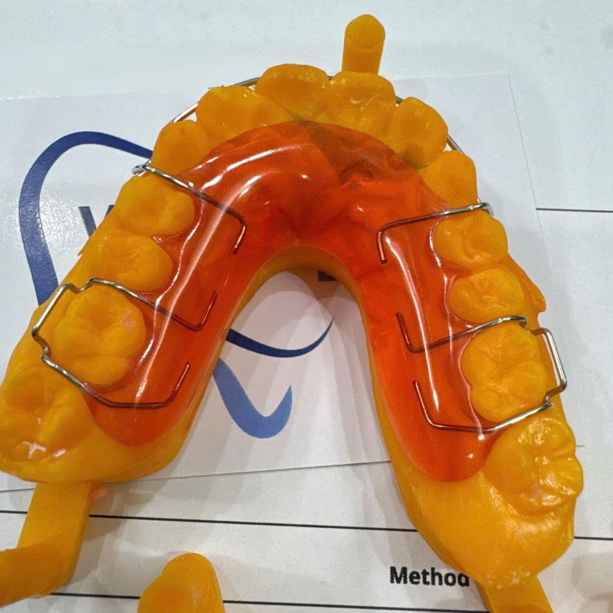 Ảnh Hàm duy trì Hawley (kim loại) do Viet Dental Lab sản xuất
