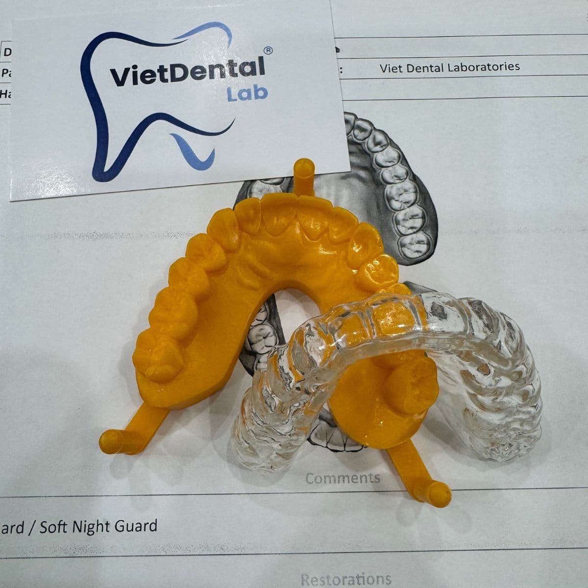 Ảnh Hàm chống nghiến nhựa Đức do Viet Dental Lab sản xuất