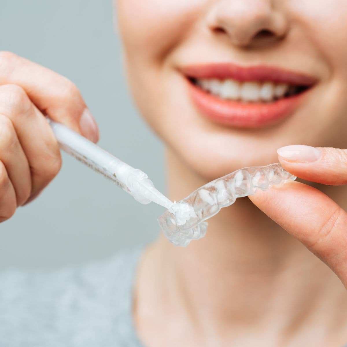 Ảnh Khay tẩy trắng răng do Viet Dental Lab sản xuất